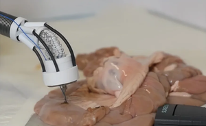 Этот 3D-принтер восстановит  поврежденные ткани изнутри